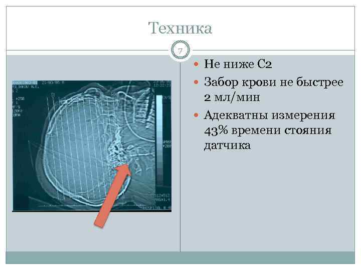 Техника 7 Не ниже С 2 Забор крови не быстрее 2 мл/мин Адекватны измерения