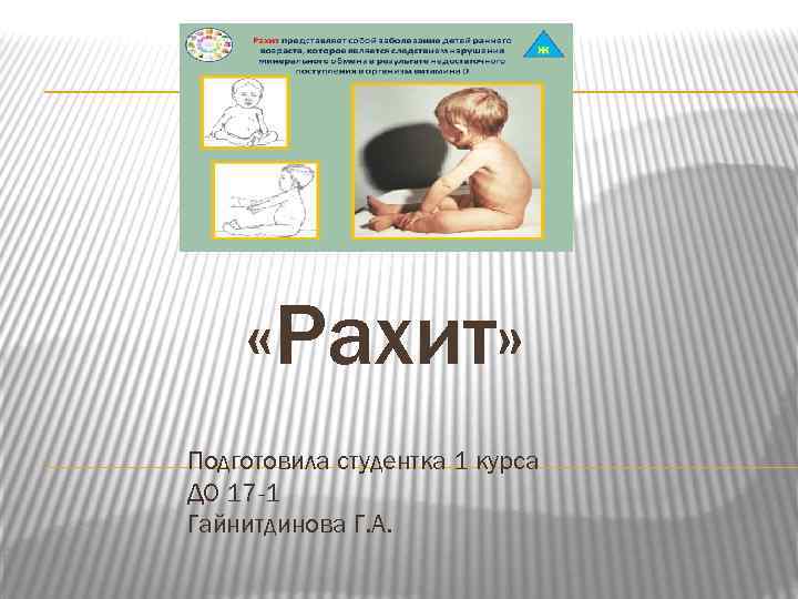  «Рахит» Подготовила студентка 1 курса ДО 17 -1 Гайнитдинова Г. А. 