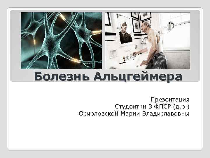 Болезнь Альцгеймера Презентация Студентки 3 ФПСР (д. о. ) Осмоловской Марии Владиславовны 