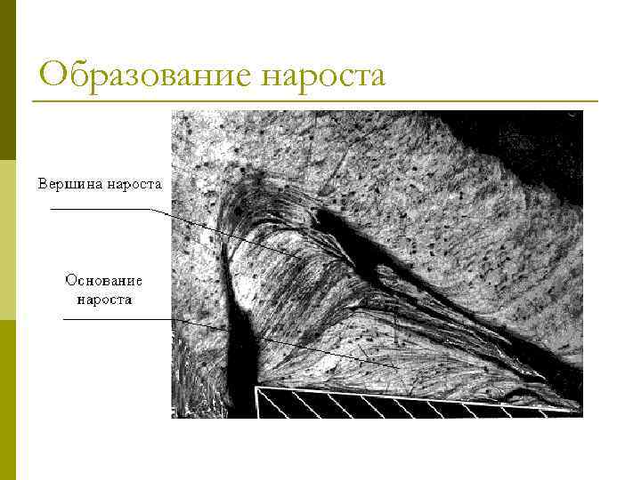 Образование нароста 