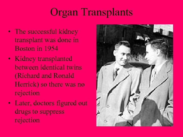 Organ Transplants • The successful kidney transplant was done in Boston in 1954 •