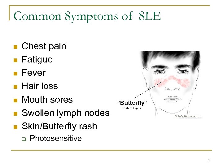 Common Symptoms of SLE n n n n Chest pain Fatigue Fever Hair loss