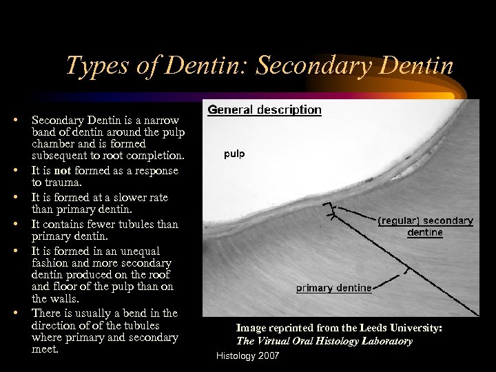 Types of Dentin: Secondary Dentin • • • Secondary Dentin is a narrow band