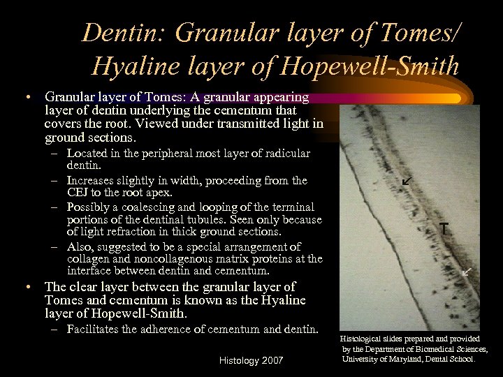 Dentin: Granular layer of Tomes/ Hyaline layer of Hopewell-Smith • Granular layer of Tomes: