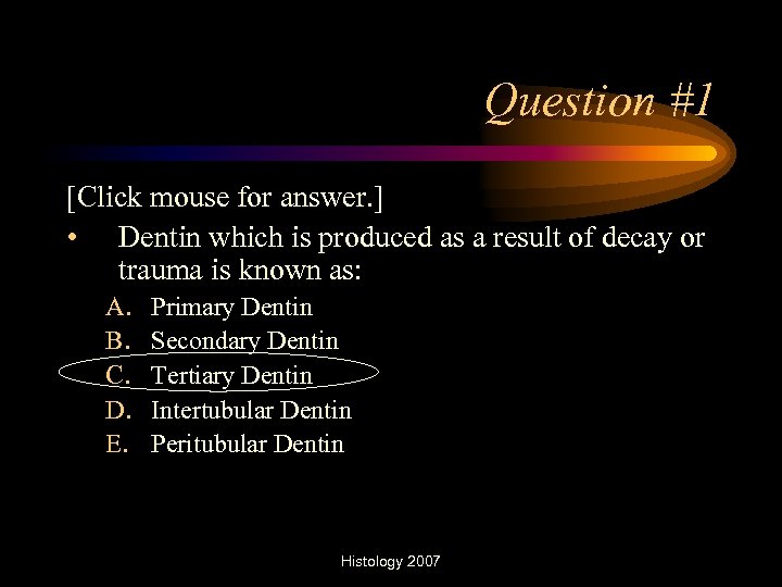 Question #1 [Click mouse for answer. ] • Dentin which is produced as a