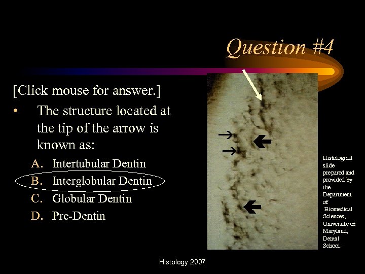 Question #4 [Click mouse for answer. ] • The structure located at the tip