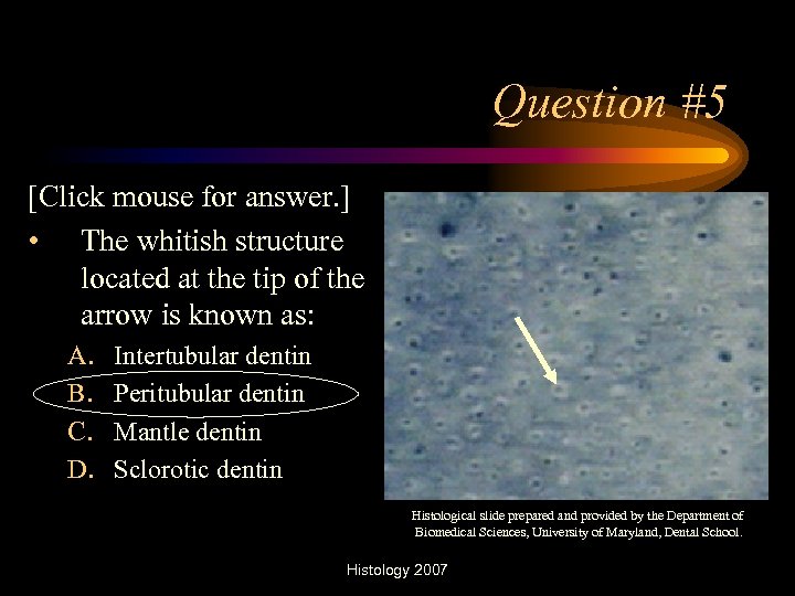 Question #5 [Click mouse for answer. ] • The whitish structure located at the