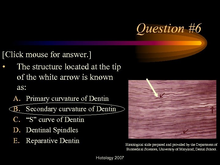 Question #6 [Click mouse for answer. ] • The structure located at the tip