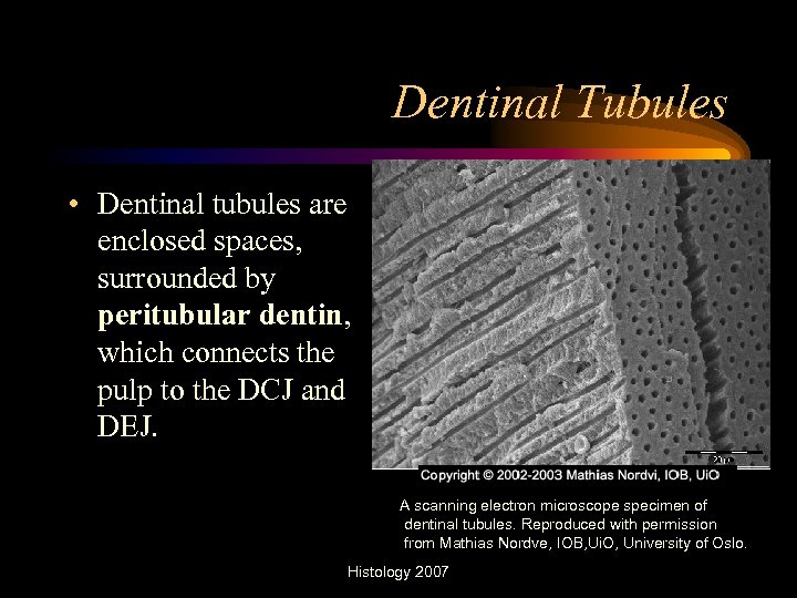 Dentinal Tubules • Dentinal tubules are enclosed spaces, surrounded by peritubular dentin, which connects