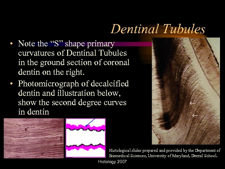 Dentinal Tubules • Note the “S” shape primary curvatures of Dentinal Tubules in the