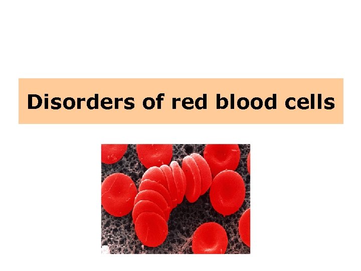 Disorders of red blood cells 