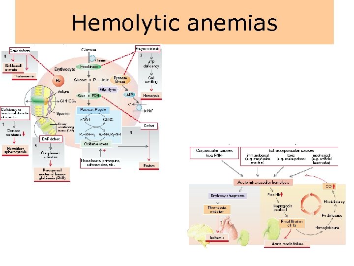 Hemolytic anemias 