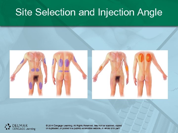 Site Selection and Injection Angle © 2014 Cengage Learning. All Rights Reserved. May not