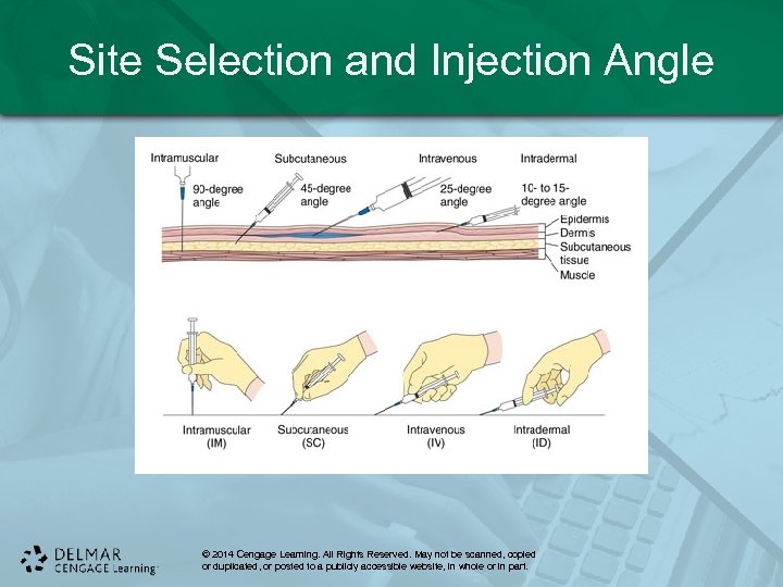 Site Selection and Injection Angle © 2014 Cengage Learning. All Rights Reserved. May not