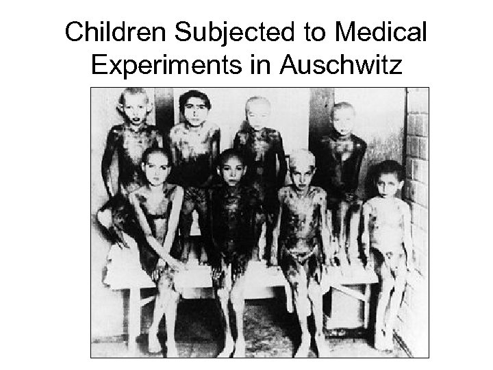 Children Subjected to Medical Experiments in Auschwitz 