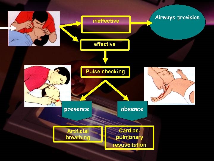 Airways provision ineffective Pulse checking presence Artificial breathing absence Cardiacpulmonary resuscitation 