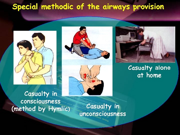 Special methodic of the airways provision Casualty alone at home Casualty in consciousness (method