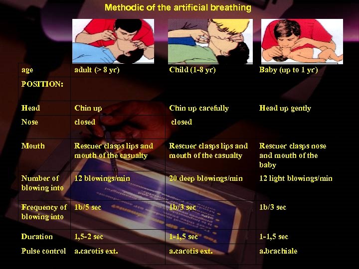 Methodic of the artificial breathing age adult (> 8 yr) Child (1 -8 yr)