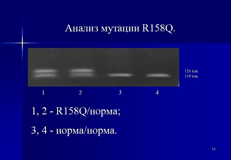 Анализ мутации R 158 Q. 123 п. н. 119 п. н. 1 2 3