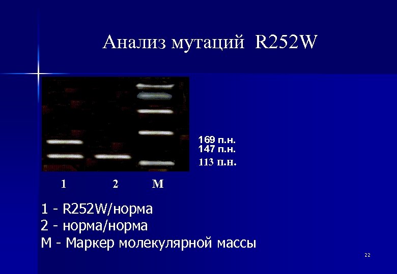 Анализ мутаций R 252 W 169 п. н. 147 п. н. 113 п. н.