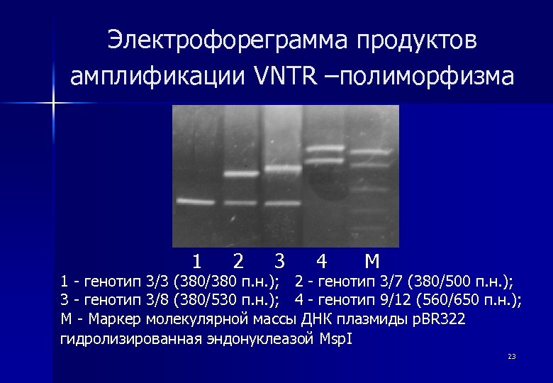 Электрофореграмма продуктов амплификации VNTR –полиморфизма 1 2 3 4 М 1 - генотип 3/3