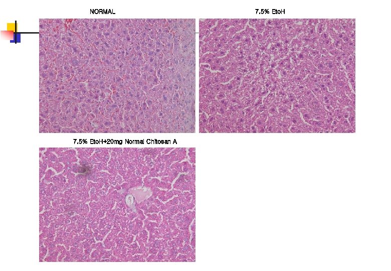 NORMAL 7. 5% Eto. H+20 mg Normal Chitosan A 7. 5% Eto. H 