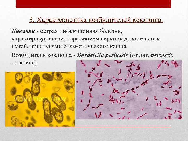 3. Характеристика возбудителей коклюша. Коклюш - острая инфекционная болезнь, характеризующаяся поражением верхних дыхательных путей,