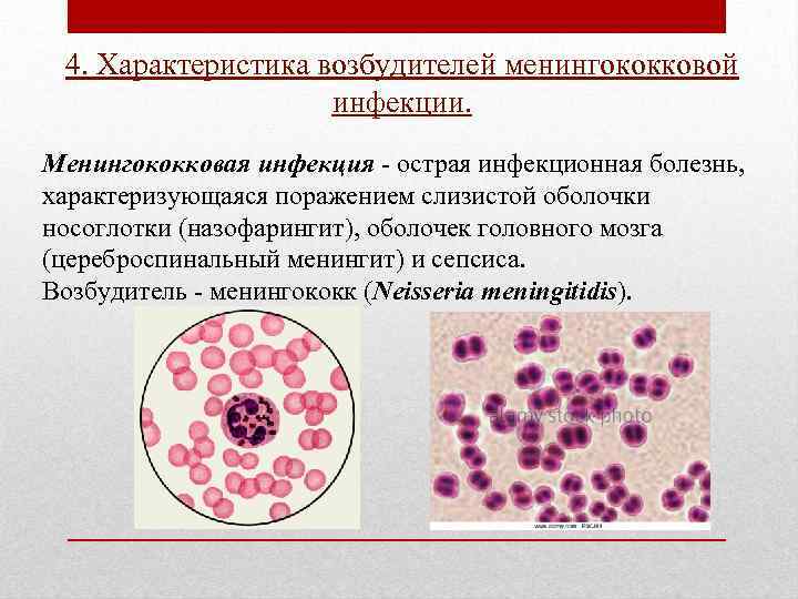 4. Характеристика возбудителей менингококковой инфекции. Менингококковая инфекция - острая инфекционная болезнь, характеризующаяся поражением слизистой