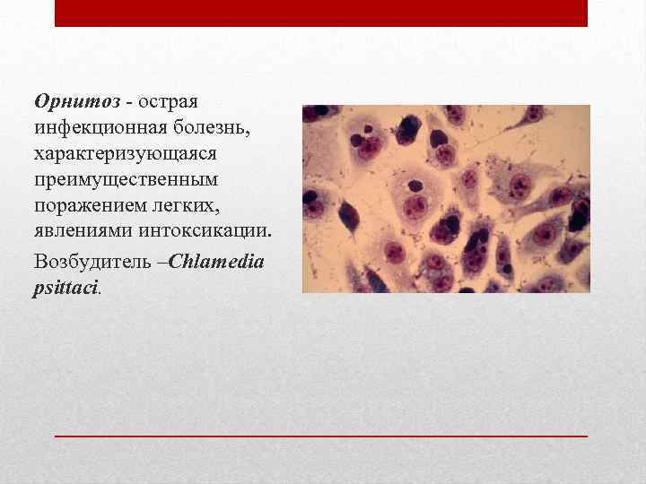 Орнитоз - острая инфекционная болезнь, характеризующаяся преимущественным поражением легких, явлениями интоксикации. Возбудитель –Chlamedia psittaci.