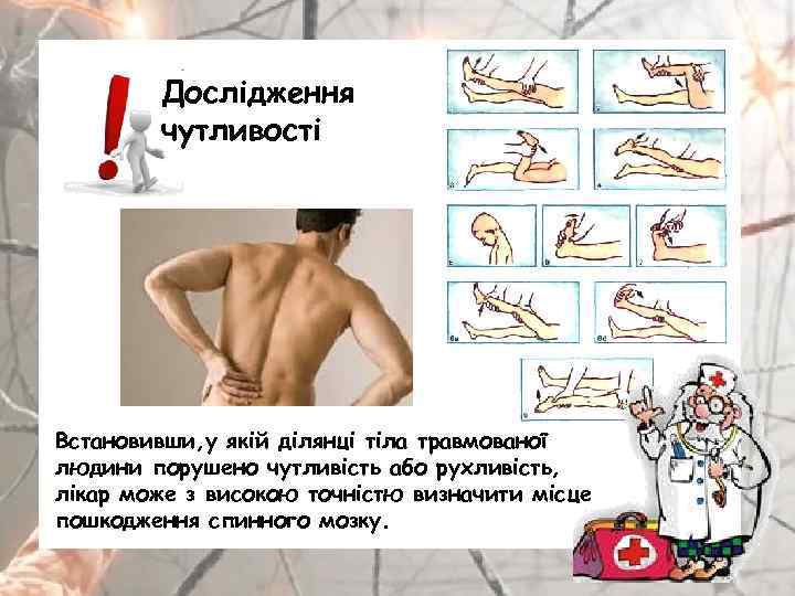 Дослідження чутливості Встановивши, у якій ділянці тіла травмованої людини порушено чутливість або рухливість, лікар