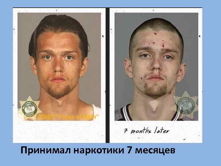 Принимал наркотики 7 месяцев 