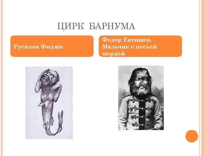 ЦИРК БАРНУМА Русалка Фиджи Федор Евтищев. Мальчик с песьей мордой 