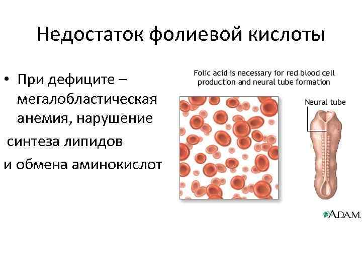 Недостаток фолиевой кислоты • При дефиците – мегалобластическая анемия, нарушение синтеза липидов и обмена