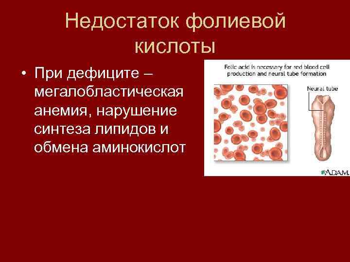 Недостаток фолиевой кислоты • При дефиците – мегалобластическая анемия, нарушение синтеза липидов и обмена