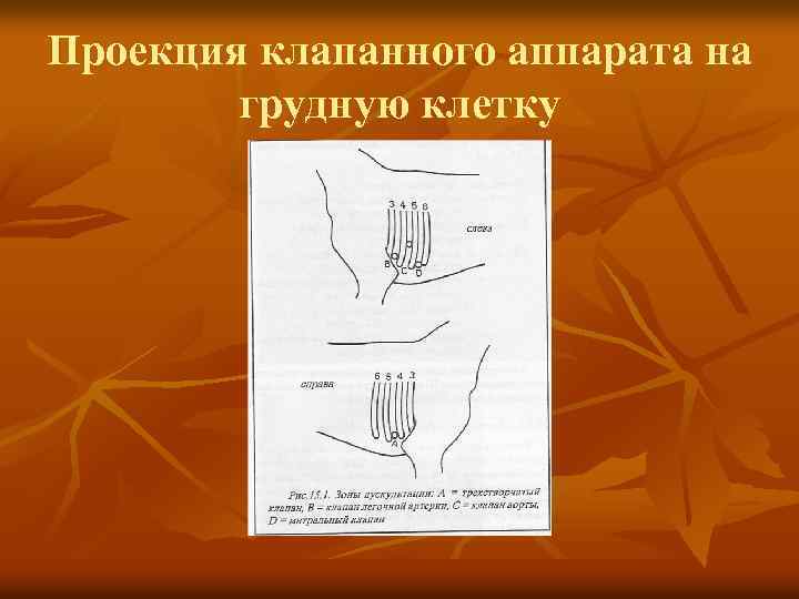 Проекция клапанного аппарата на грудную клетку 