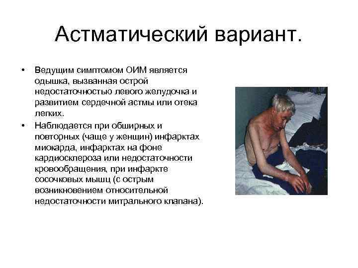 Астматический вариант. • • Ведущим симптомом ОИМ является одышка, вызванная острой недостаточностью левого желудочка