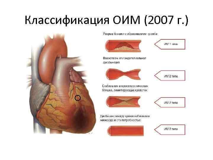Классификация ОИМ (2007 г. ) 
