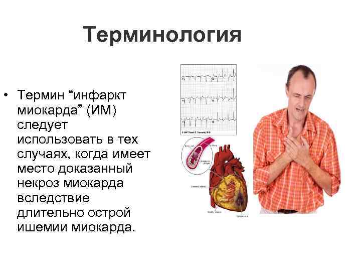 Терминология • Термин “инфаркт миокарда” (ИМ) следует использовать в тех случаях, когда имеет место