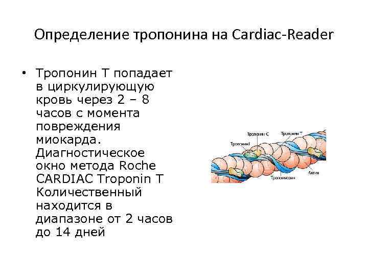 Тропонин 1 что это