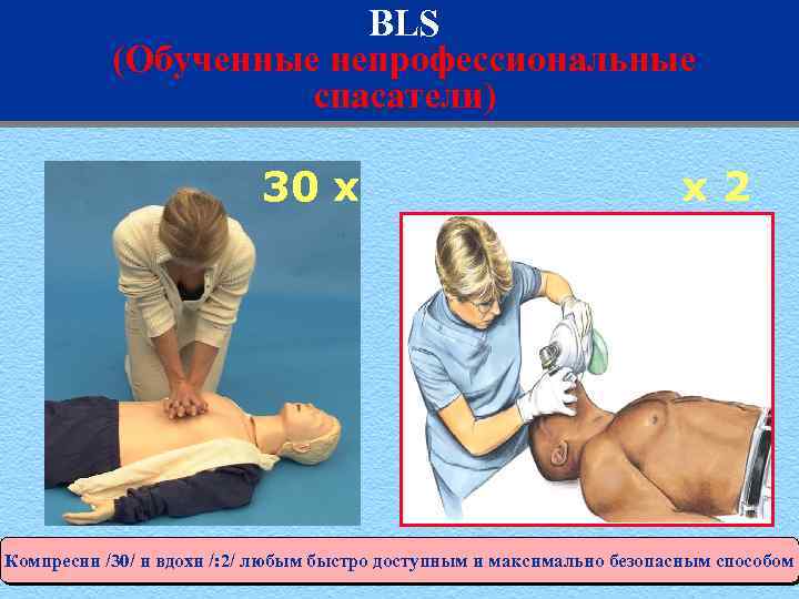 BLS (Обученные непрофессиональные спасатели) 30 x x 2 Компресии /30/ и вдохи /: 2/