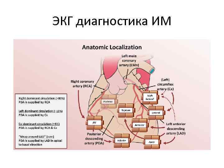 ЭКГ диагностика ИМ 