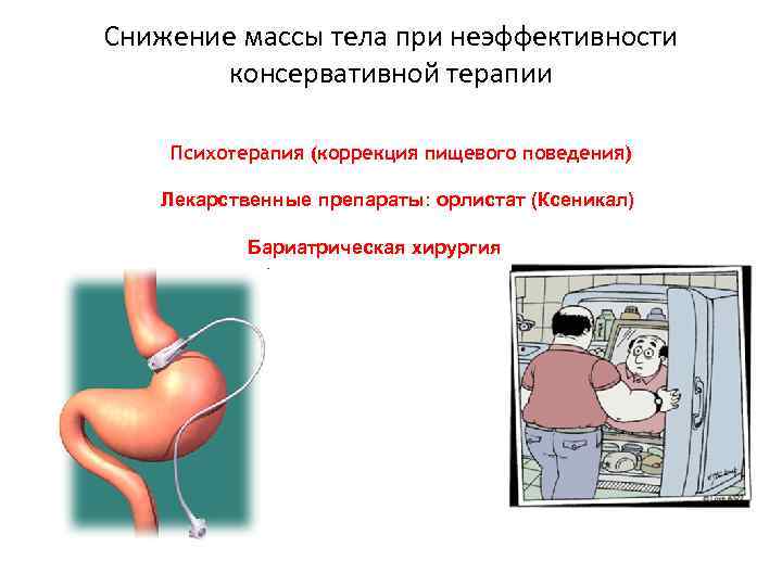 Снижение массы тела при неэффективности консервативной терапии Психотерапия (коррекция пищевого поведения) Лекарственные препараты: орлистат