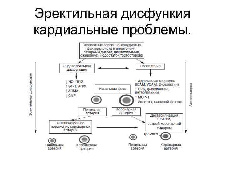 Эректильная дисфункия кардиальные проблемы. 