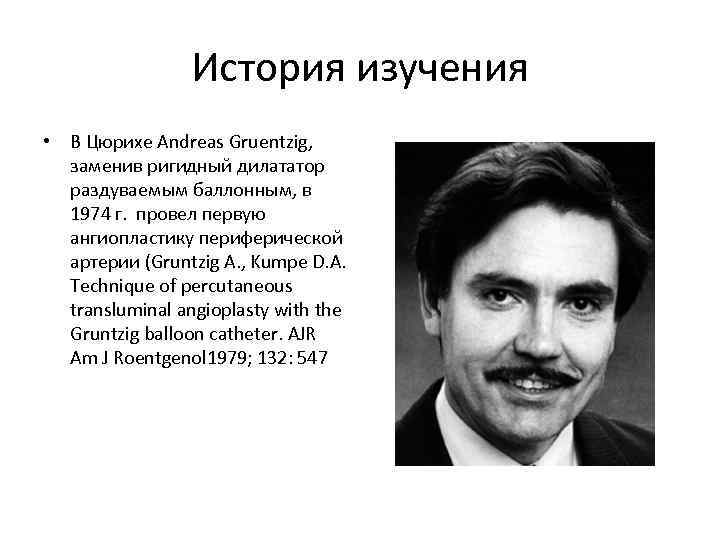 История изучения • В Цюрихе Andreas Gruentzig, заменив ригидный дилататор раздуваемым баллонным, в 1974