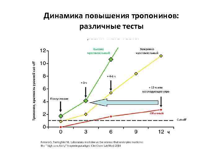 Динамика повышения тропонинов: различные тесты 