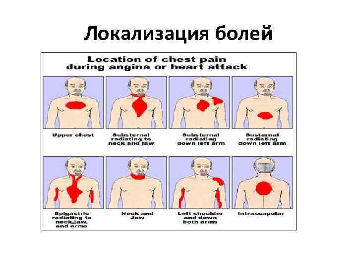 Локализация болей 