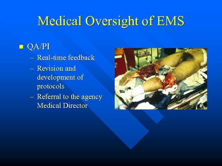 Medical Oversight of EMS n QA/PI – Real-time feedback – Revision and development of