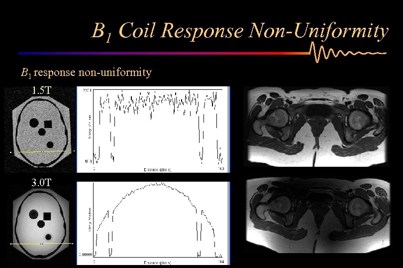 B 1 Coil Response Non-Uniformity B 1 response non-uniformity 1. 5 T 3. 0