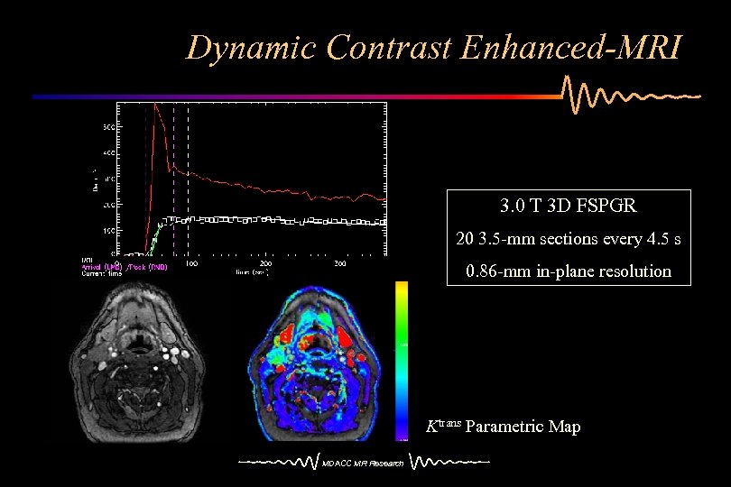Dynamic Contrast Enhanced-MRI 3. 0 T 3 D FSPGR 20 3. 5 -mm sections