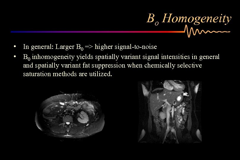 Bo Homogeneity • In general: Larger B 0 => higher signal-to-noise • B 0